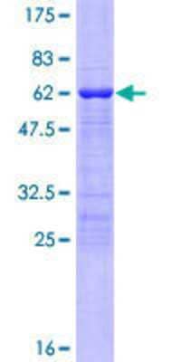 12.5% SDS-PAGE Stained with Coomassie Blue.