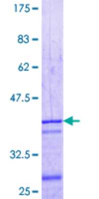 12.5% SDS-PAGE Stained with Coomassie Blue.