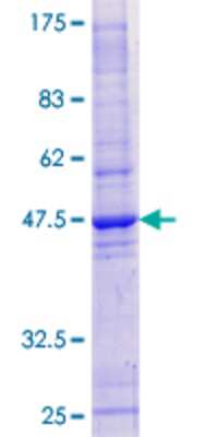 SDS-Page: Recombinant Human HRAS like suppressor Protein [H00057110-P01] - 12.5% SDS-PAGE Stained with Coomassie Blue.