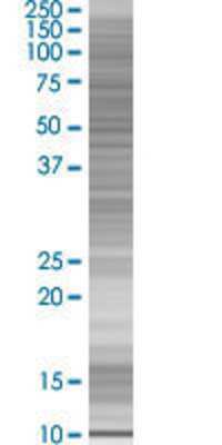 ZNF695 transfected lysate.