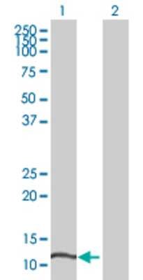 Lane 1: ZNF695 transfected lysate (14.74 KDa) Lane 2: Non-transfected lysate.