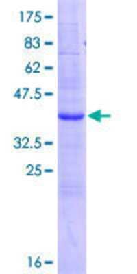 12.5% SDS-PAGE Stained with Coomassie Blue.