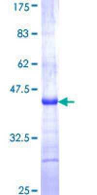 Recombinant Human SPINLW1 Protein [H00057119-Q01] - 12.5% SDS-PAGE Stained with Coomassie Blue.