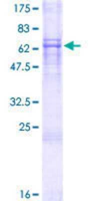 Other Recombinant Human Deleted in azoospermia 4 GST (N-Term) Protein