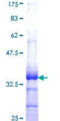 12.5% SDS-PAGE Stained with Coomassie Blue.