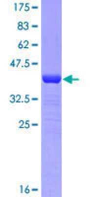 12.5% SDS-PAGE Stained with Coomassie Blue.