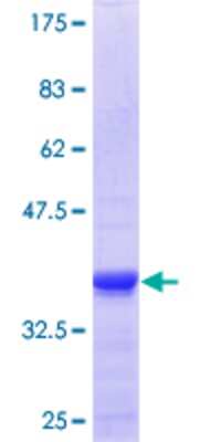 12.5% SDS-PAGE Stained with Coomassie Blue.