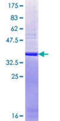 SDS-Page: Recombinant Human THOC2 Protein [H00057187-Q01] - 12.5% SDS-PAGE Stained with Coomassie Blue.