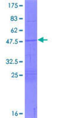 12.5% SDS-PAGE Stained with Coomassie Blue.