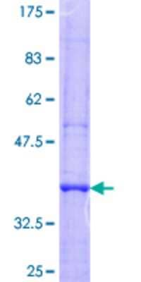 12.5% SDS-PAGE Stained with Coomassie Blue.