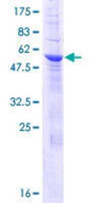 12.5% SDS-PAGE Stained with Coomassie Blue.