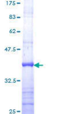 12.5% SDS-PAGE Stained with Coomassie Blue.