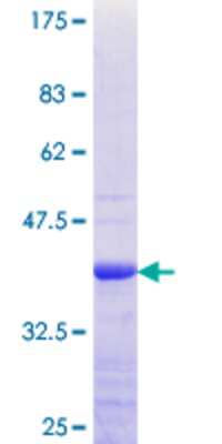 12.5% SDS-PAGE Stained with Coomassie Blue.