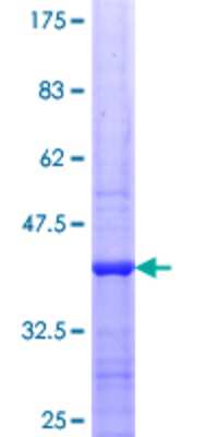 12.5% SDS-PAGE Stained with Coomassie Blue.