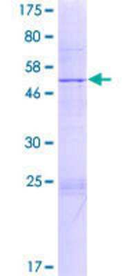 12.5% SDS-PAGE Stained with Coomassie Blue.