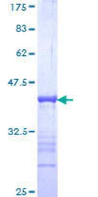 Other Recombinant Human p66 beta GST (N-Term) Protein
