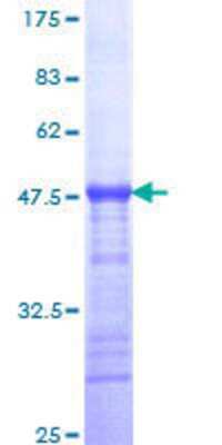12.5% SDS-PAGE Stained with Coomassie Blue.