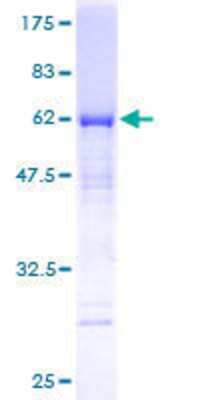 Other Recombinant Human MTUS1 GST (N-Term) Protein