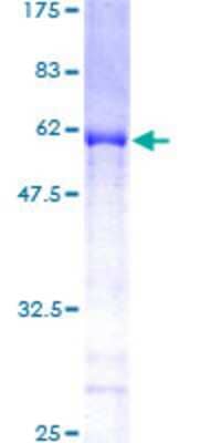 12.5% SDS-PAGE Stained with Coomassie Blue.