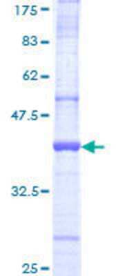 Other Recombinant Human HACE1 GST (N-Term) Protein