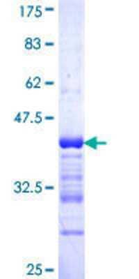 SDS-Page: Recombinant Human ALPK3 Protein [H00057538-Q01] - 12.5% SDS-PAGE Stained with Coomassie Blue.