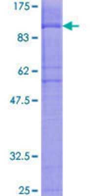 12.5% SDS-PAGE Stained with Coomassie Blue.