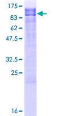 12.5% SDS-PAGE Stained with Coomassie Blue.