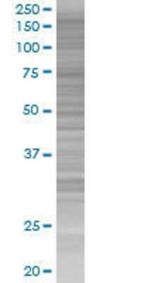 PCDH10 transfected lysate.