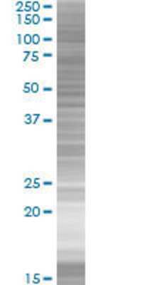 RP5-860F19.3 transfected lysate.