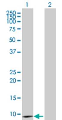 Lane 1: RP5-860F19.3 transfected lysate (9.79 KDa) Lane 2: Non-transfected lysate.