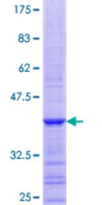 SDS-Page: Recombinant Human p400 Protein [H00057634-Q01] - 12.5% SDS-PAGE Stained with Coomassie Blue.