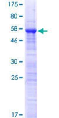 SDS-Page: Recombinant Human UVSSA Protein [H00057654-P01] - 12.5% SDS-PAGE Stained with Coomassie Blue.