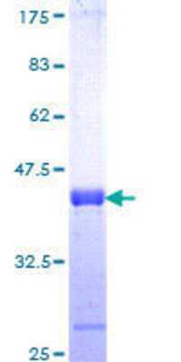 12.5% SDS-PAGE Stained with Coomassie Blue.