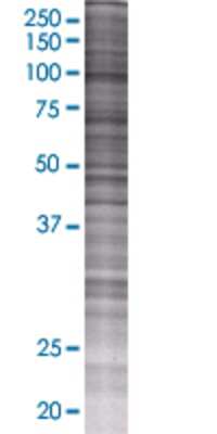 GPAM transfected lysate.