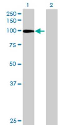 Lane 1: GPAM transfected lysate (91.19 KDa) Lane 2: Non-transfected lysate.