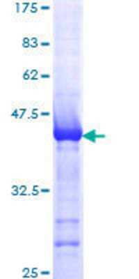 SDS-Page: Recombinant Human Als2 Protein [H00057679-Q01] - 12.5% SDS-PAGE Stained with Coomassie Blue.