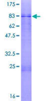 12.5% SDS-PAGE Stained with Coomassie Blue.