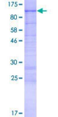12.5% SDS-PAGE Stained with Coomassie Blue.