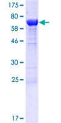 SDS-PAGE Recombinant Human TLDC1 GST (N-Term) Protein