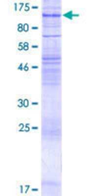 12.5% SDS-PAGE Stained with Coomassie Blue.