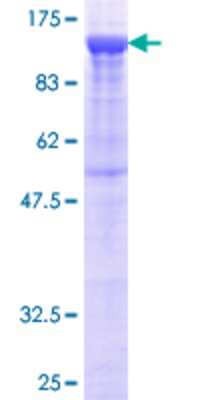12.5% SDS-PAGE Stained with Coomassie Blue.