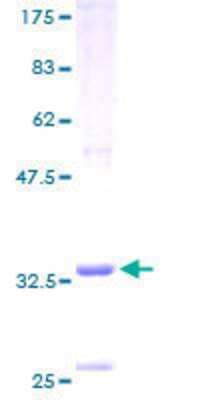 SDS-Page: Recombinant Human MARK4 Protein [H00057787-P01] - 12.5% SDS-PAGE Stained with Coomassie Blue.
