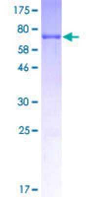 Other Recombinant Human DBC1/p30 GST (N-Term) Protein