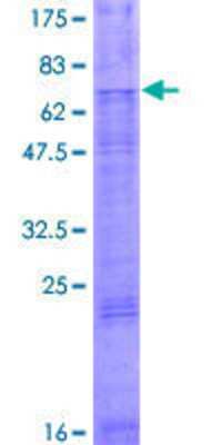 SDS-Page: Recombinant Human TSCOT Protein [H00057864-P01] - 12.5% SDS-PAGE Stained with Coomassie Blue.