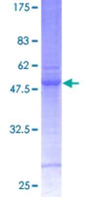 12.5% SDS-PAGE Stained with Coomassie Blue.