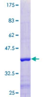 Other Recombinant Human SSBIP1/SOSS-C GST (N-Term) Protein