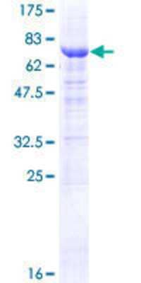 12.5% SDS-PAGE Stained with Coomassie Blue.