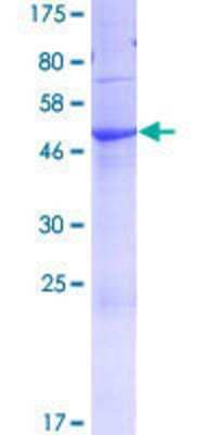 12.5% SDS-PAGE Stained with Coomassie Blue.