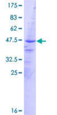 12.5% SDS-PAGE Stained with Coomassie Blue.
