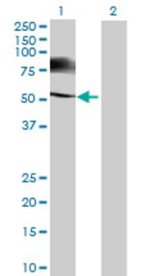 Lane 1: TSKS transfected lysate (64.9 KDa) Lane 2: Non-transfected lysate.